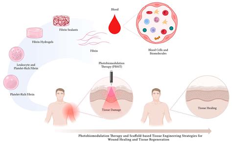  Fibrin: Ett Naturligt Material För Biokompatibilitet Och Vävnadsåteruppbyggnad?