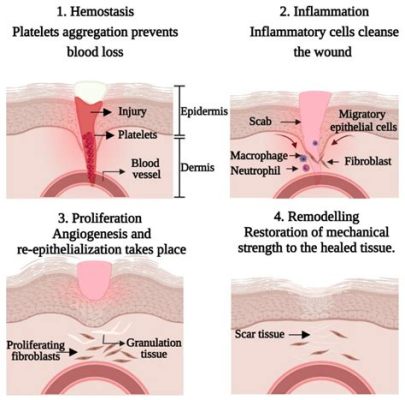  Fibrin: Revolutionerande Biomaterial för Vektivvävnadning och Sårläkning!